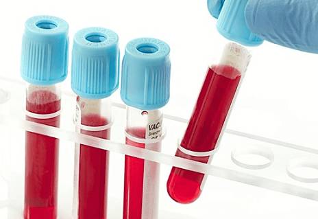 Взятие анализа крови