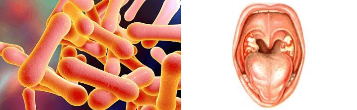 Распространение инфекции