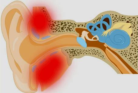 Воспаление в ушной раковине