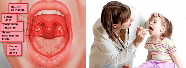 Причины заболевания