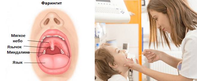 Симптомы заболевания