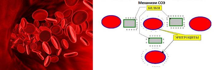 Установка механизма СОЭ
