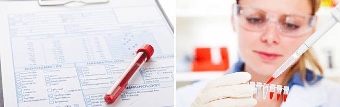 Расшифровка анализа крови
