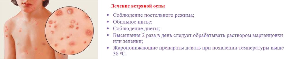 Методы лечения заболевания у детей