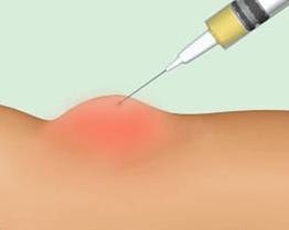 Противопоказания для детей