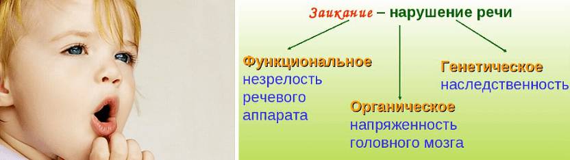 Признаки заикания