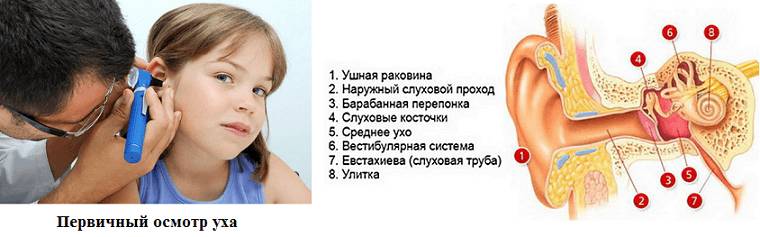 Слуховой проход у ребенка