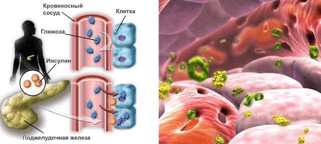 Симптомы тяжелого заболевания