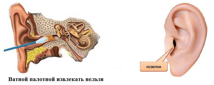 Использование методов в лечении ушей