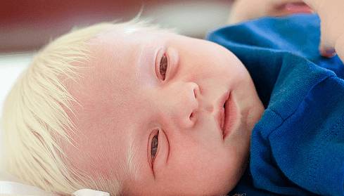 Причины болезни у детей