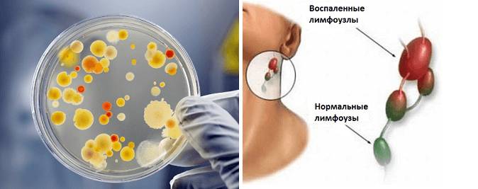 Фото болезни