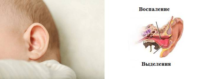 Выделения из ушей