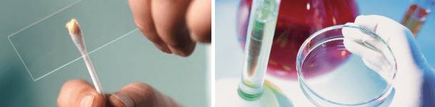 Исследование болезни