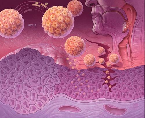 проникновение вируса папилломы человека