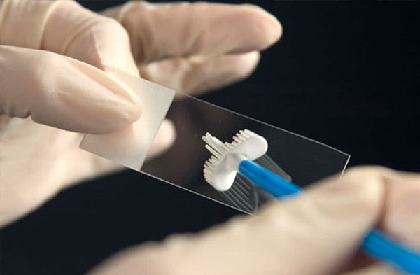 гинекологический мазок