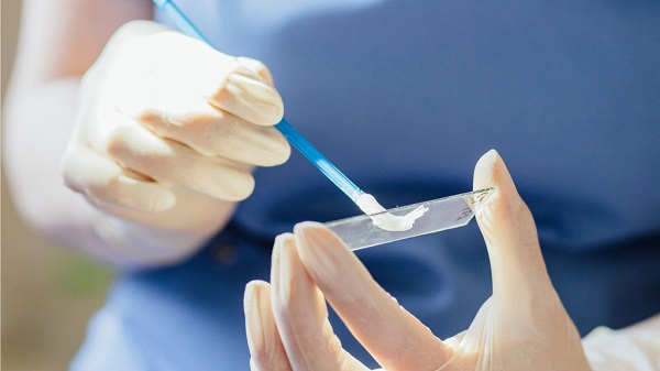 Цитологическое исследование шейки матки