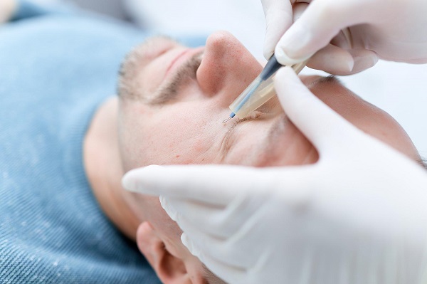 удаление папиллом на веках радиоволновым методом