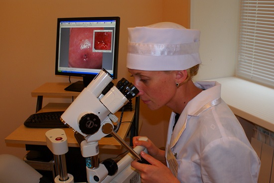 кольпоскопия шейки матки