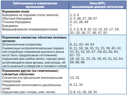 фото: типы впч