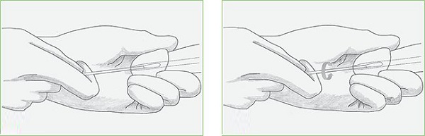 взятие мазка у мужчин