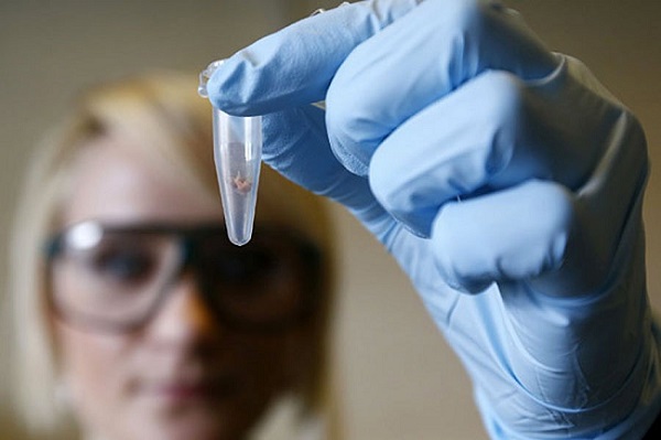 кусочек биоматериала на исследование