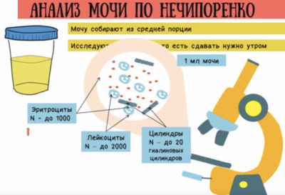 Анализ мочи