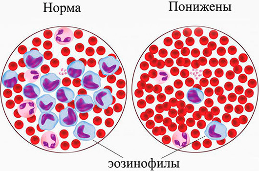 Эозинофилы