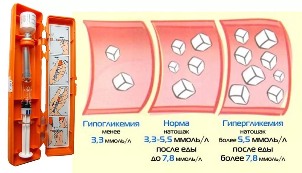 Гипо и гипергликемия
