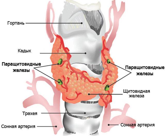 Киста паращитовидной железы