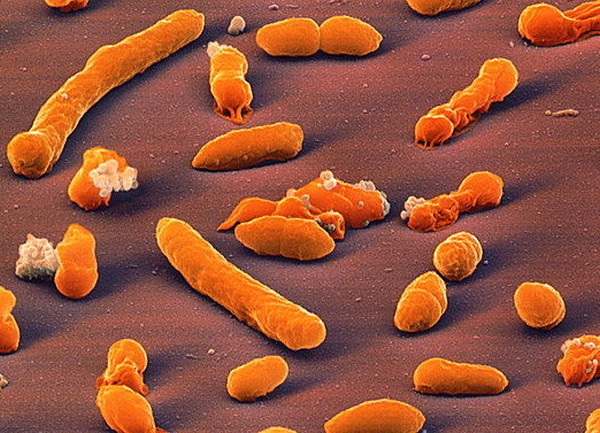 Klebsiella oxytocа