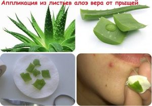 Алоэ от прыщей на лице