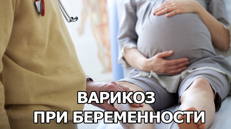 Что делать если варикоз при беременности на ногах