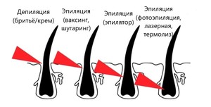 Депиляция или эпиляция разница