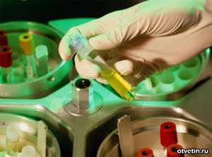 Способы диагностирования Токсоплазмоза Диагностирование Токсоплазмоза