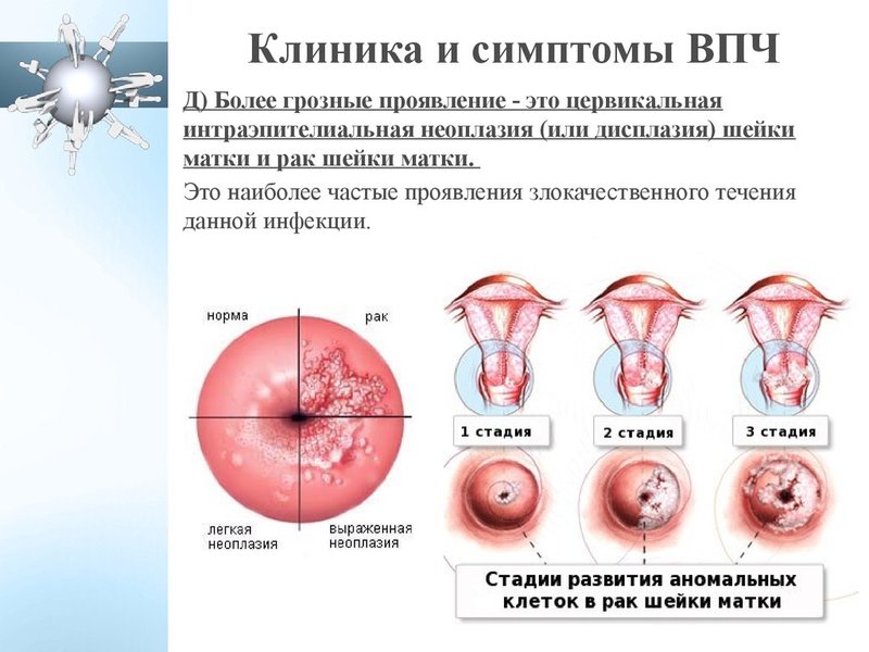 Факторы, провоцирующие болезнь