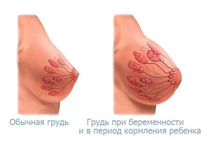 Грудь во время беременности