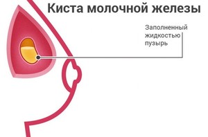 Характерные симптомы