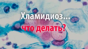 Хламидий хламидиоз