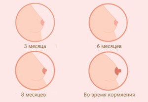 Изменение груди во время беременности