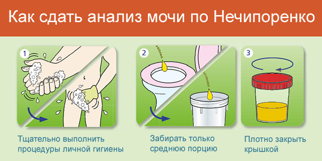 Анализ мочи по Нечипоренко
