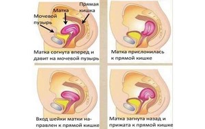 Как зачать плод Какие позы выбирать для зачатия ребенка