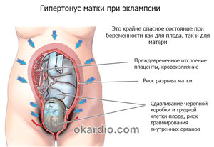 Диагностирование тонуса матки Какие признаки тонуса матки проявляются