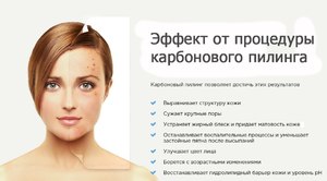 Карбоновый пилинг