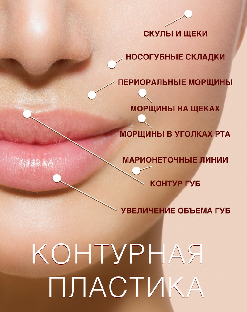 Коррекция овала лица филлерами