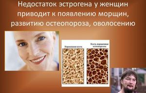 Лечение недостатка эстрогенов у женщин