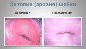 Лечение женского здоровья