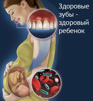 Лечим зубы