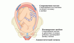 Приичины гипертонуса Как лечить гипертонус