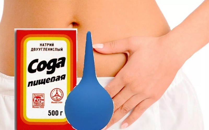 Как лечить молочницу