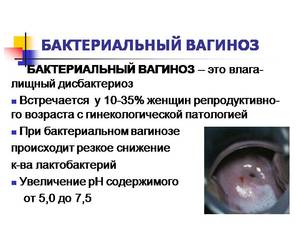 Анибиотики при бактериальном вагинозе Как лечить вагиноз